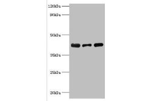 Western blot All lanes: Alpha-2, 8-sialyltransferase 8B antibody at 8 μg/mL Lane 1: Mouse heart tissue Lane 2: HepG2 whole cell lysate Lane 3: Mouse kidney tissue Secondary Goat polyclonal to rabbit IgG at 1/10000 dilution Predicted band size: 42 kDa Observed band size: 42 kDa (ST8SIA2 Antikörper  (AA 24-160))