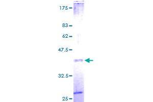 Image no. 1 for beta-2-Microglobulin (B2M) (AA 1-119) protein (GST tag) (ABIN1346265)