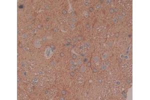 Used in DAB staining on fromalin fixed paraffin- embedded brain tissue (BCAT1 Antikörper  (AA 179-411))