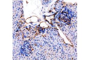 IHC analysis of CD31/Pecam1 using anti-CD31/Pecam1 antibody (ABIN7601662). (CD31 Antikörper  (AA 41-258))