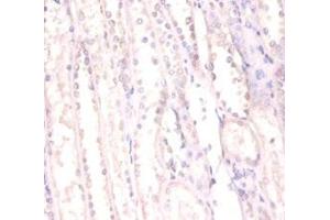 Immunohistochemistry of paraffin-embedded human kidney tissue using ABIN7168366 at dilution of 1:100 (FUS Antikörper  (AA 1-198))