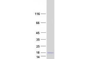 Western Blotting (WB) image for Chemokine (C-C Motif) Ligand 15 (CCL15) (Transcript Variant 1) protein (Myc-DYKDDDDK Tag) (ABIN2713961)