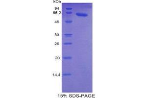 SDS-PAGE (SDS) image for Fast Skeletal Troponin C (TNNC2) (AA 2-160) protein (His tag,MBP tag) (ABIN1878361)