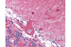 Anti-STMN1 antibody IHC of human brain, cerebellum. (Stathmin 1 Antikörper  (Ser37))