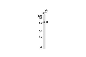 Western Blotting (WB) image for anti-Cytochrome P450, Family 27, Subfamily B, Polypeptide 1 (CYP27B1) antibody (ABIN2897847) (CYP27B1 Antikörper)