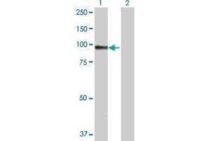Western Blot analysis of ACTN1 expression in transfected 293T cell line by ACTN1 MaxPab polyclonal antibody. (ACTN1 Antikörper  (AA 1-892))