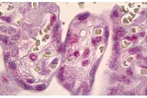 Anti-MSK1 antibody IHC staining of human placenta. (MSK1 Antikörper)