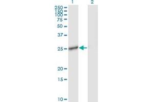 Western Blot analysis of IL27 expression in transfected 293T cell line by IL27 monoclonal antibody (M01), clone 3F12. (IL-27 Antikörper  (AA 177-243))