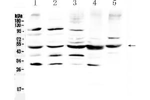 Western blot analysis of Bag5 using anti- Bag5 antibody . (BAG5 Antikörper  (AA 389-447))