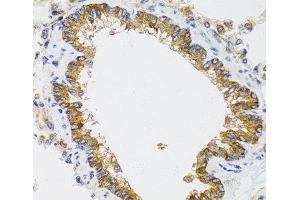 Immunohistochemistry of paraffin-embedded Rat lung using CHMP4B Polyclonal Antibody at dilution of 1:100 (40x lens). (CHMP4B Antikörper)