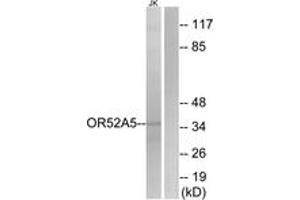 Western blot analysis of extracts from Jurkat cells, using OR52A5 Antibody.