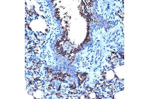Immunohistochemistry of paraffin-embedded rat lung using MUC1 Rabbit pAb (ABIN6131522, ABIN6144194, ABIN6144195 and ABIN6213810) at dilution of 1:100 (40x lens). (MUC1 Antikörper  (AA 1182-1255))