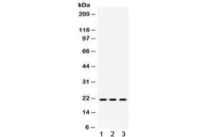 Western blot testing of 1) mouse brain, 2) human HeLa and 3) human A549 lysate with HRAS antibody.