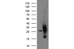 Western Blotting (WB) image for anti-Adenylate Kinase 4 (AK4) antibody (ABIN1496530) (AK4 Antikörper)