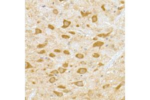 Immunohistochemistry of paraffin-embedded mouse brain using DENN Rabbit mAb (ABIN7268396) at dilution of 1:50 (40x lens). (MADD Antikörper)