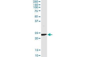 Immunoprecipitation of UBE2T transfected lysate using anti-UBE2T monoclonal antibody and Protein A Magnetic Bead , and immunoblotted with UBE2T MaxPab rabbit polyclonal antibody. (Ube2t Antikörper  (AA 1-197))