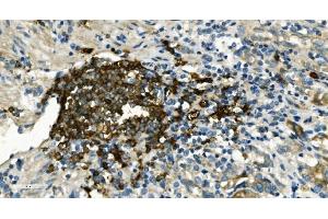 IHC analysis of CD20/MS4A1 using anti-CD20/MS4A1 antibody (ABIN7599233). (CD20 Antikörper  (AA 1-297))