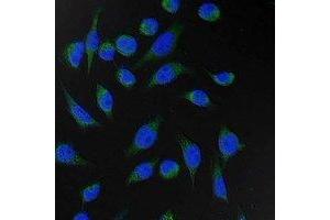 Immunofluorescent analysis of Fumarase staining in Hela cells. (FH Antikörper)