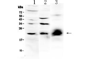 Western blot analysis of IL-22 using anti-IL-22 antibody . (IL-22 Antikörper  (AA 34-179))