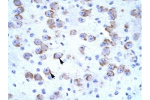 CATSPER2 antibody was used for immunohistochemistry at a concentration of 4-8 ug/ml to stain Neural cells (arrows) in Human Brain. (CATSPER2 Antikörper  (N-Term))