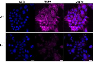 Immunocytochemical staining of HeLa cells using PDLIM1 antibody (ABIN7799748), 1:1,000), Top panel: wild-type (WT), Bottom panal: PDLIM1 shRNA knockdown (KD). (Rekombinanter PDLIM1 Antikörper)