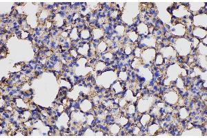 Immunohistochemistry of paraffin-embedded Mouse lung using ANXA5 Polycloanl Antibody at dilution of 1:150 (Annexin V Antikörper)