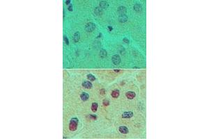 Image no. 1 for anti-One Cut Homeobox 1 (ONECUT1) (AA 420-470) antibody (ABIN960298)