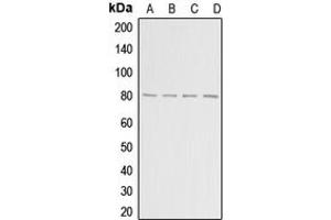 Western blot analysis of ADAR2 expression in HepG2 (A), MCF7 (B), mouse brain (C), rat brain (D) whole cell lysates. (RED1 Antikörper  (Center))