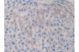 Used in DAB staining on fromalin fixed paraffin- embedded kidney tissue (FLT1 Antikörper  (AA 303-524))