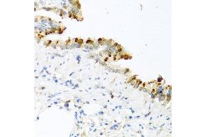 Immunohistochemistry of paraffin-embedded mouse lung using BMP4 antibody at dilution of 1:100 (40x lens). (BMP4 Antikörper)