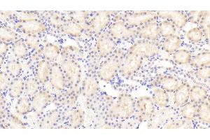 Immunohistochemistry (IHC) image for anti-Nuclear Factor (erythroid-Derived 2)-Like 2 (NFE2L2) (AA 382-604) antibody (ABIN7441676)