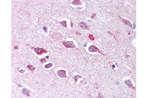 Anti-TLL2 antibody IHC of human brain, neurons and glia. (Tolloid-Like 2 Antikörper  (CUB2 Domain))