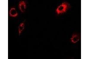 Immunofluorescent analysis of Tropomodulin-4 staining in U2OS cells. (Tropomodulin 4 Antikörper)