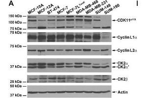 Expression of CDK11 and CK2 protein complex members in untransformed and malignant breast cells. (Cyclin L2 Antikörper  (AA 309-384))