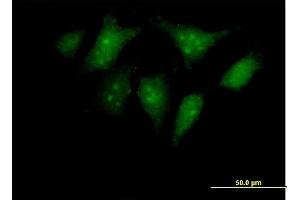 Immunofluorescence of purified MaxPab antibody to RBED1 on HeLa cell. (ELMOD3 Antikörper  (AA 1-391))