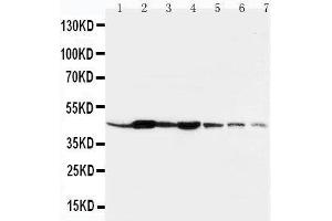 Lane 1: Rat Liver Tissue LysateLane 2: Rat Spleen Tissue LysateLane 3: Rat Brain Tissue LysateLane 4: Rat Kidney Tissue LysateLane 5: HELA Cell LysateLane 6: SMMC Cell LysateLane 7: SGC Cell Lysate (beta Actin Antikörper  (N-Term))