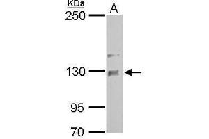 WB Image NCKAP1 antibody [C1C2], Internal detects NCKAP1 protein by Western blot analysis. (NCKAP1 Antikörper)