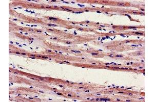 Immunohistochemistry of paraffin-embedded human heart tissue using ABIN7152948 at dilution of 1:100 (FILIP1 Antikörper  (AA 957-1192))