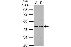 WB Image Sample (30 ug of whole cell lysate) A: H1299 B: HCT116 10% SDS PAGE antibody diluted at 1:1000 (PDCD2 Antikörper)