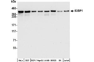 Western Blotting (WB) image for anti-Tumor Protein P53 Binding Protein 1 (TP53BP1) (AA 350-400) antibody (ABIN7455070)