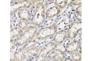 Immunohistochemistry of paraffin-embedded Rat kidney using RNF166 Polyclonal Antibody (RNF166 Antikörper)
