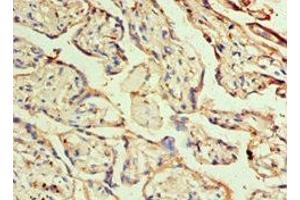 Immunohistochemistry of paraffin-embedded human placenta tissue using ABIN7155678 at dilution of 1:100 (DLX3 Antikörper  (AA 1-120))