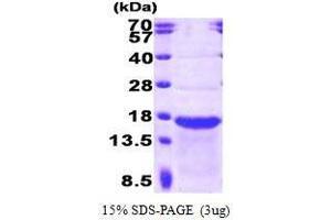 Figure annotation denotes ug of protein loaded and % gel used. (Stathmin-Like 2 (STMN2) (AA 39-179) Peptid)