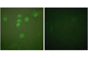 Immunofluorescence analysis of HeLa cells, using CREB (Ab-142) Antibody. (CREB1 Antikörper  (AA 111-160))