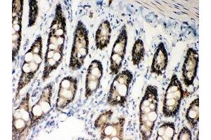 IHC-P: MSH2 antibody testing of rat intestine tissue (MSH2 Antikörper  (AA 337-583))