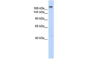 DYSF antibody used at 1 ug/ml to detect target protein. (Dysferlin Antikörper)