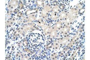 Cytokeratin 17 antibody was used for immunohistochemistry at a concentration of 4-8 ug/ml to stain Epithelial cells of renal tubule (arrows) in Human Kidney. (KRT17 Antikörper  (C-Term))