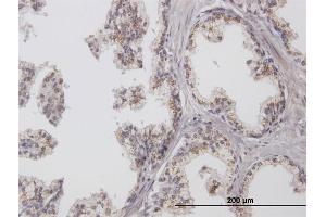 Immunoperoxidase of purified MaxPab antibody to ChGn on formalin-fixed paraffin-embedded human prostate. (CSGALNACT1 Antikörper  (AA 1-297))