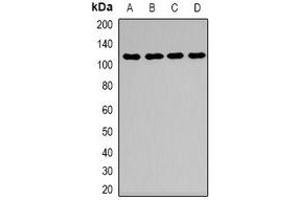 Western blot analysis of Desmoglein 1 expression in HEK293T (A), mouse kidney (B), mouse brain (C), mouse lung (D) whole cell lysates. (Desmoglein 1 Antikörper  (N-Term))