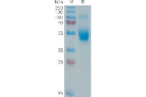 Human IL3 Protein, hFc Tag on SDS-PAGE under reducing condition.